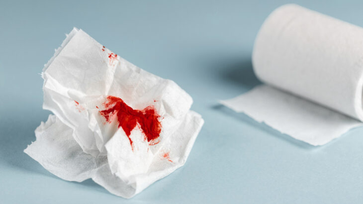 Sangramento anal ou sangue nas fezes pode ser causado por qualquer sangramento ao longo do tubo que vai da boca ao ânus. Saiba quando o problema exige uma visita ao médico.