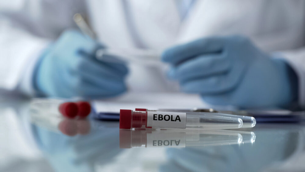 close em vidro de exame para Ebola à frente de mão de médico com luvas