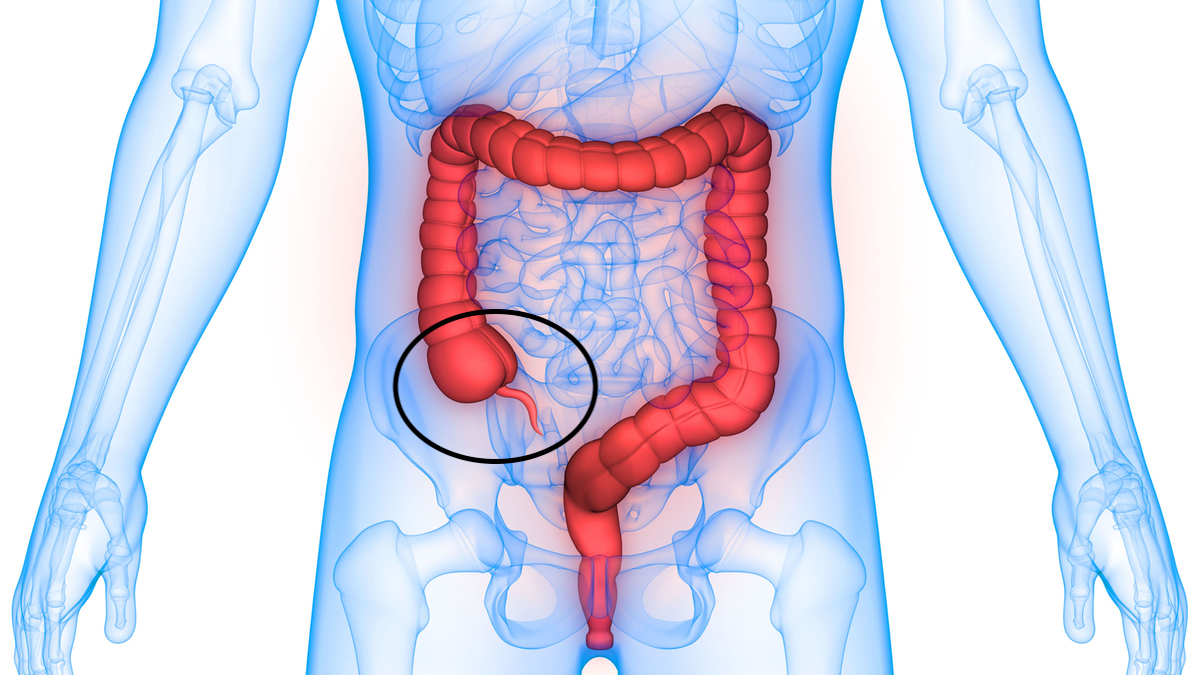 intestino grosso com destaque para a região do ceco