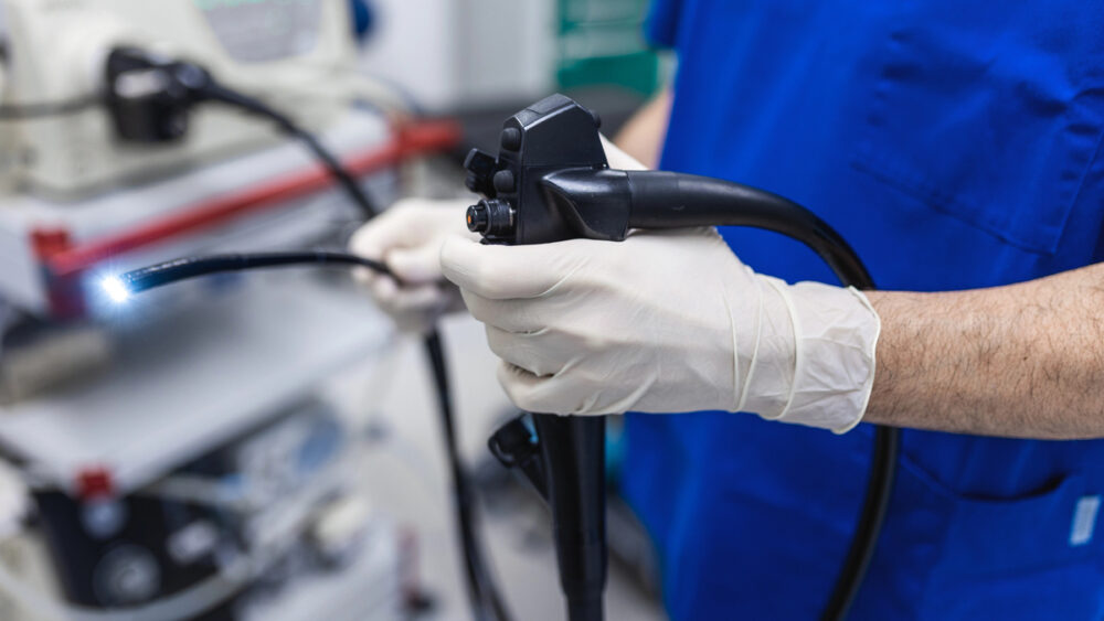 médico segura colonoscópio para realizar colonoscopia