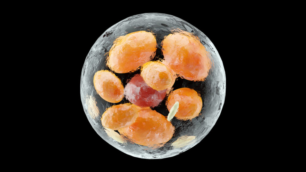 O corpo é composto de gordura branca, marrom e bege. Entenda as diferenças entre elas