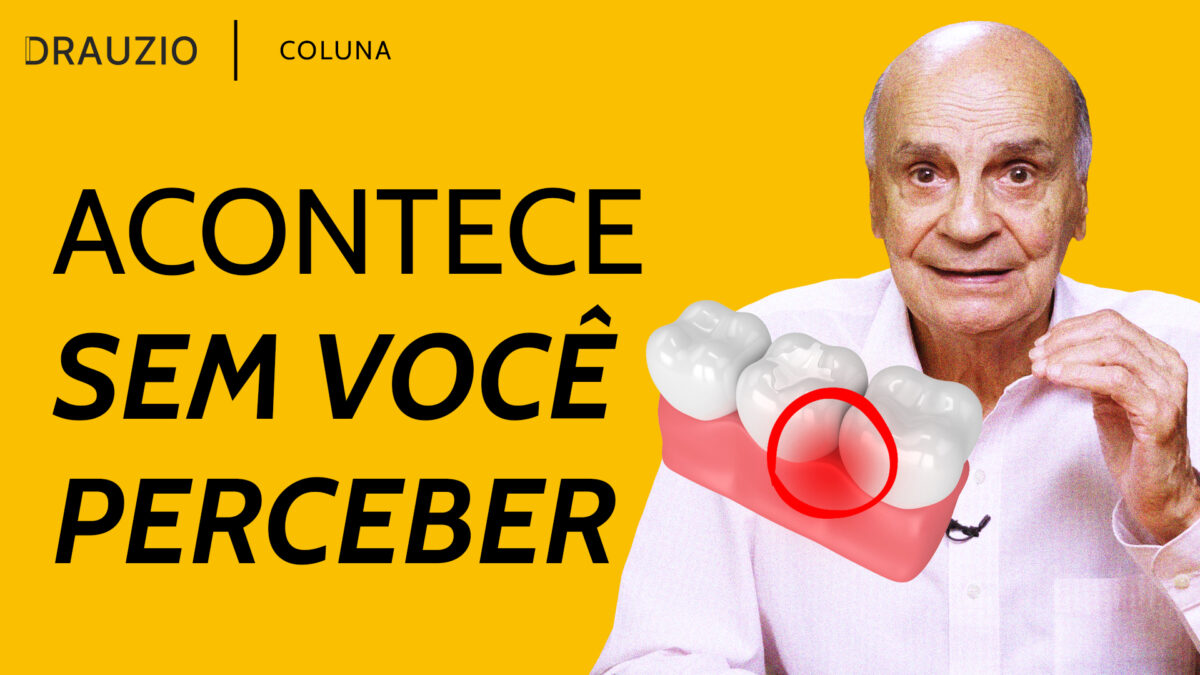 A periodontite é uma condição odontológica que pode ter consequências para o cérebro e o coração. Entenda