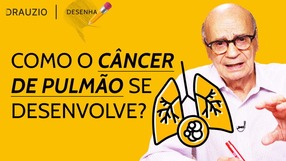 Veja na prática como o tabagismo provoca câncer de pulmão