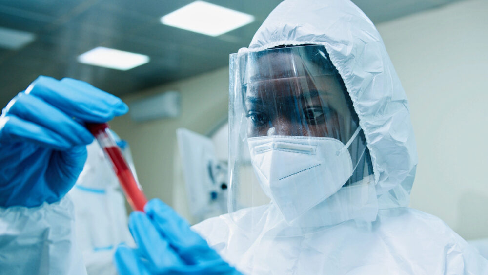 Cientista com EPI segura tubo com sangue para exame de Ebola em laboratório