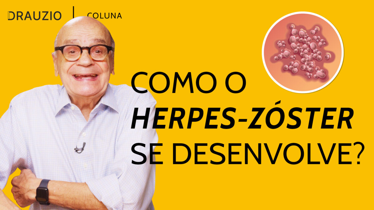 O herpes-zóster é causado pelo mesmo vírus da catapora e causa dor persistente. Saiba como se prevenir