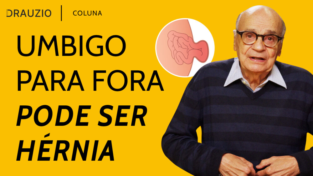 A hérnia umbilical é mais comum em recém-nascidos, mas também pode acometer adultos. Entenda