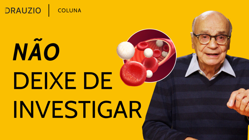 A leucopenia acontece quando os glóbulos brancos estão abaixo do limite normal e sempre exige investigação. Saiba mais