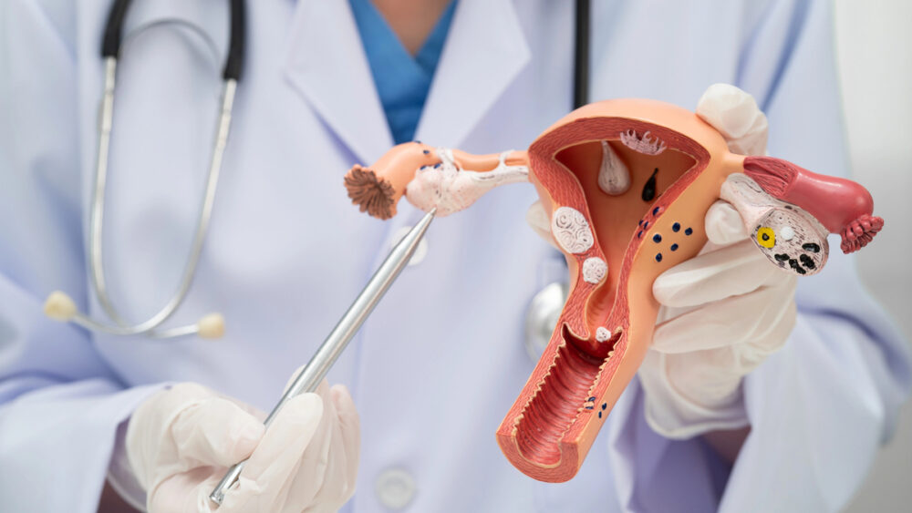 médico mostra as tubas uterinas em modelo 3D