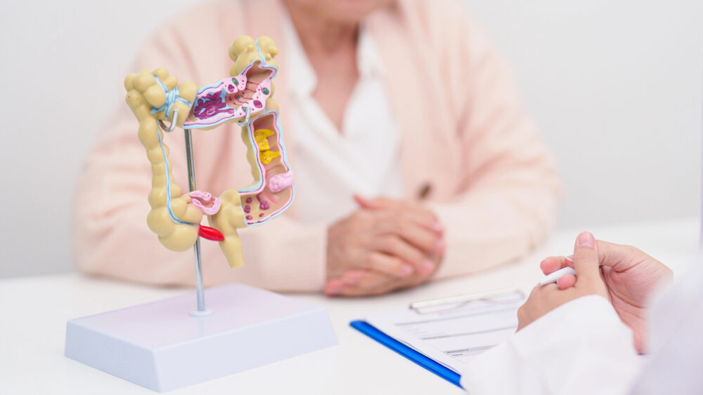paciente em frente a médico atrás da mesa, com intestino em 3D em cima da mesa