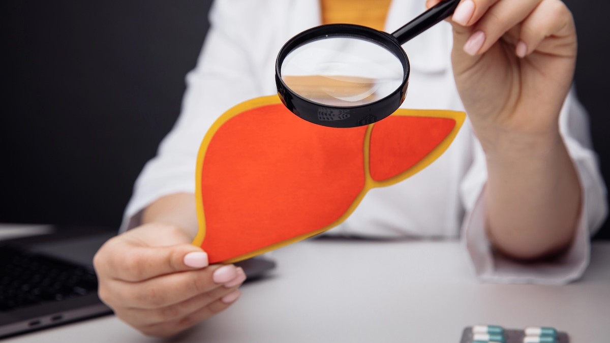 Sem sintomas, gordura no fígado com inflamação aumenta risco de problemas cardiovasculares e pode evoluir para cirrose